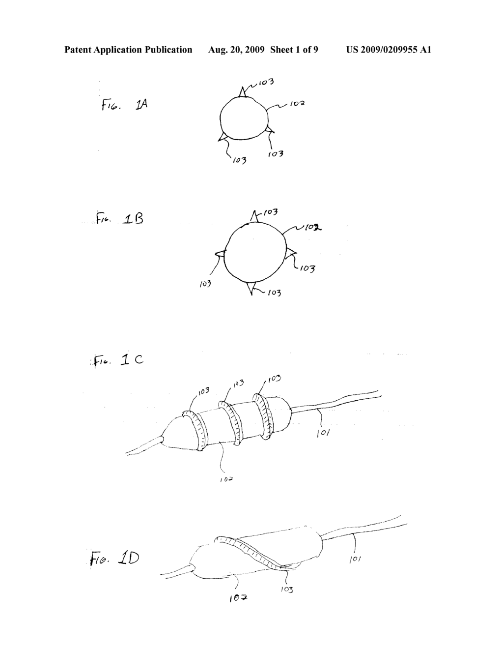 PROSTHETIC VALVE IMPLANT SITE PREPARATION TECHNIQUES - diagram, schematic, and image 02