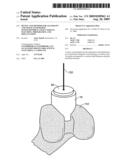 DEVICE AND METHOD FOR ALLOGRAFT AND TISSUE ENGINEERED OSTEOCHONDRAL GRAFT SURFACE MATCHING, PREPARATION, AND IMPLANTATION diagram and image