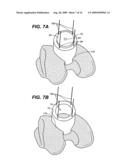 DEVICE AND METHOD FOR ALLOGRAFT AND TISSUE ENGINEERED OSTEOCHONDRAL GRAFT SURFACE MATCHING, PREPARATION, AND IMPLANTATION diagram and image