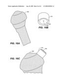 DEVICE AND METHOD FOR ALLOGRAFT AND TISSUE ENGINEERED OSTEOCHONDRAL GRAFT SURFACE MATCHING, PREPARATION, AND IMPLANTATION diagram and image