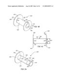 Ventilation Device and Insertion System Therefor diagram and image