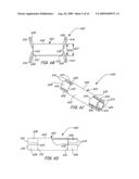 Ventilation Device and Insertion System Therefor diagram and image