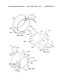 Ventilation Device and Insertion System Therefor diagram and image