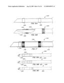 Ventilation Device and Insertion System Therefor diagram and image