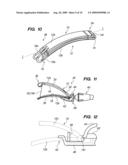 Devices, Tools and Methods for Atrial Appendage Exclusion diagram and image