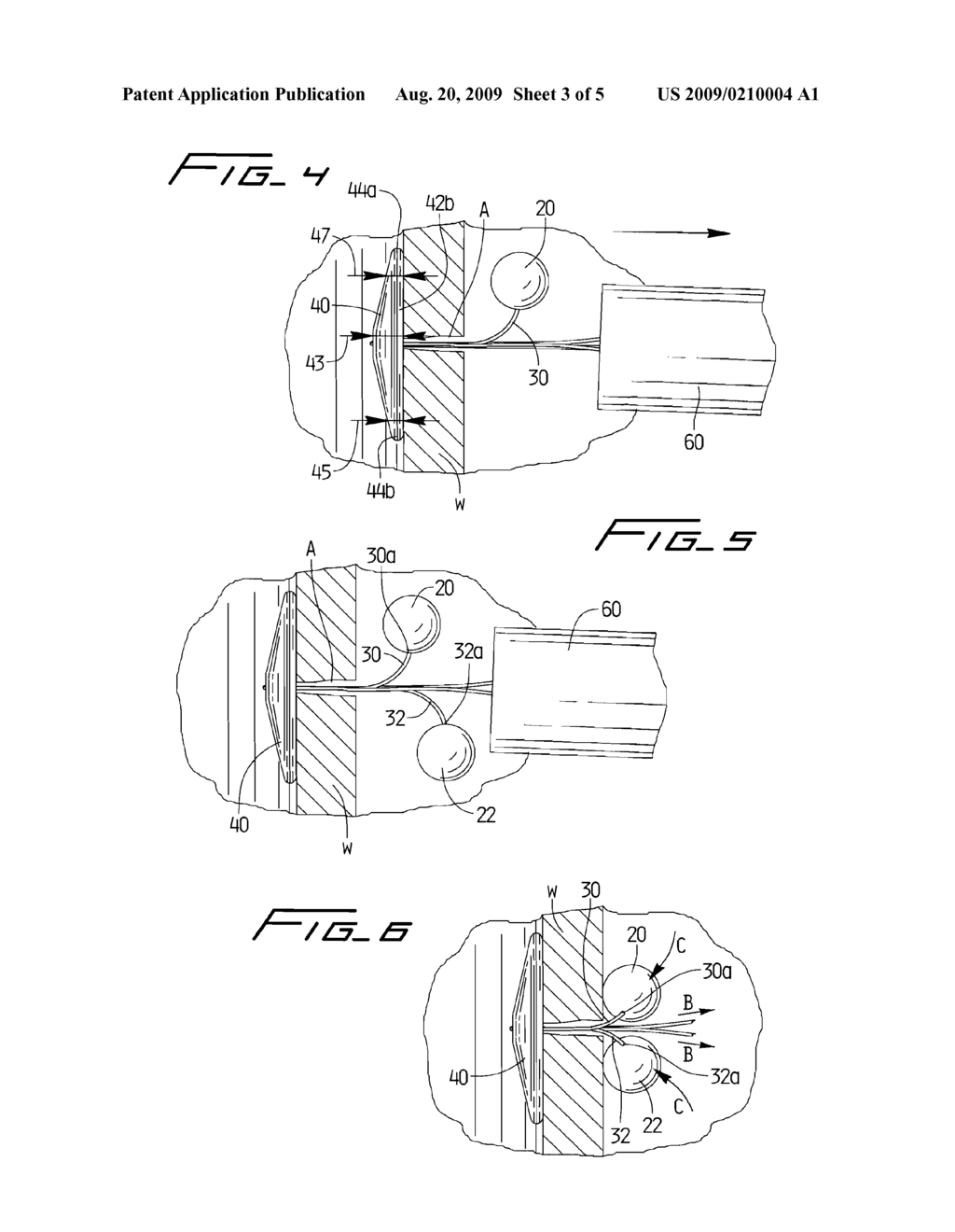 VASCULAR HOLE CLOSURE DEVICE - diagram, schematic, and image 04