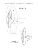 VASCULAR HOLE CLOSURE DEVICE diagram and image