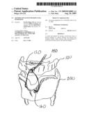 METHOD AND SYSTEM FOR DISPLACING HYOID BONE diagram and image