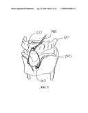 METHOD AND SYSTEM FOR DISPLACING HYOID BONE diagram and image