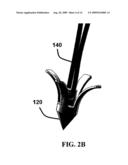 METHOD AND SYSTEM FOR DISPLACING HYOID BONE diagram and image