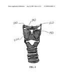 METHOD AND SYSTEM FOR DISPLACING HYOID BONE diagram and image