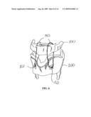 METHOD AND SYSTEM FOR DISPLACING HYOID BONE diagram and image