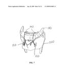 METHOD AND SYSTEM FOR DISPLACING HYOID BONE diagram and image