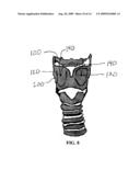 METHOD AND SYSTEM FOR DISPLACING HYOID BONE diagram and image