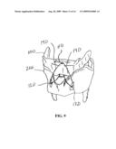 METHOD AND SYSTEM FOR DISPLACING HYOID BONE diagram and image