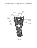 METHOD AND SYSTEM FOR DISPLACING HYOID BONE diagram and image