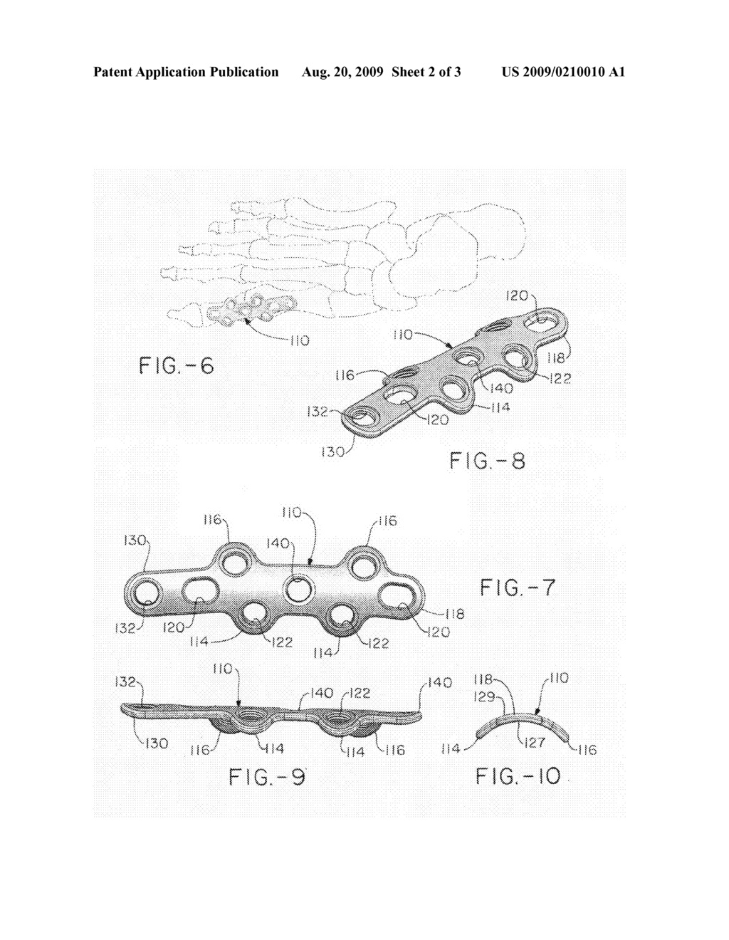 Orthopedic plate for use in the MTP joint - diagram, schematic, and image 03