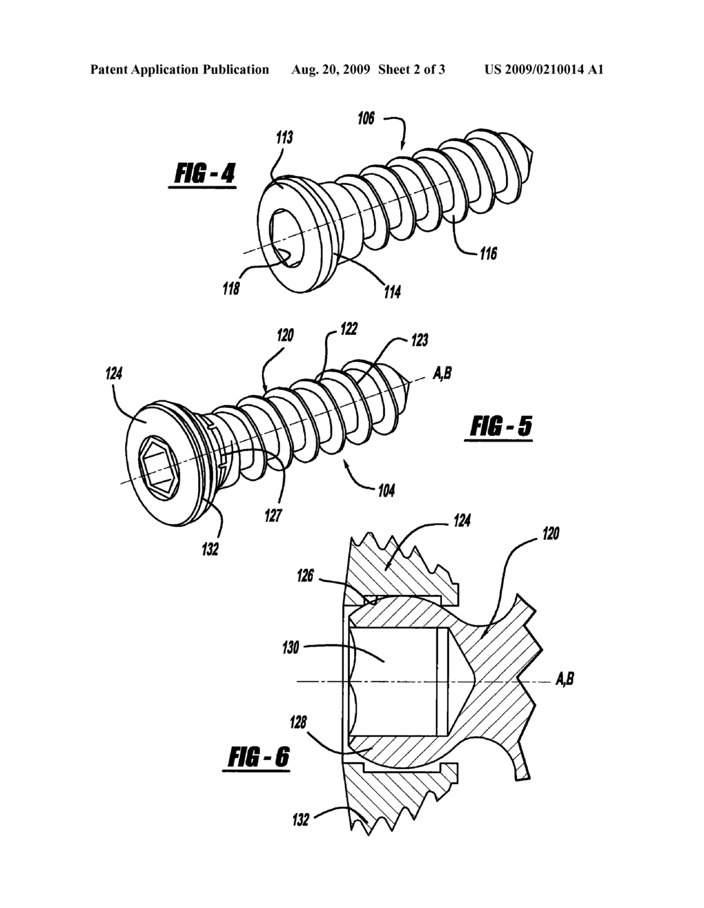 BONE FIXATION SYSTEM - diagram, schematic, and image 03