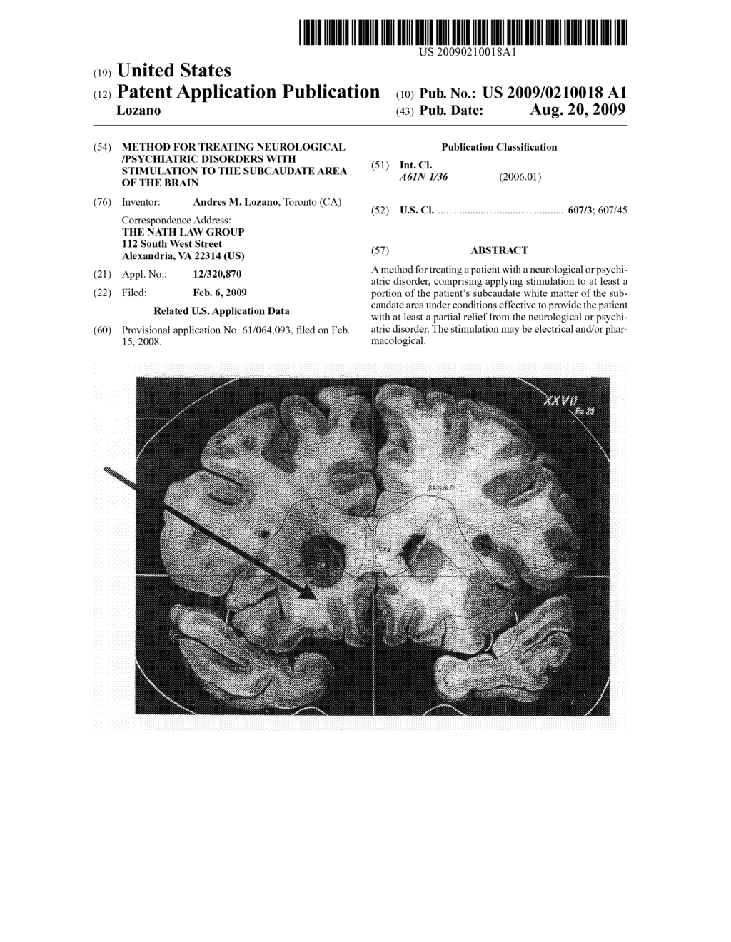 Method for treating neurological /psychiatric disorders with stimulation to the subcaudate area of the brain - diagram, schematic, and image 01