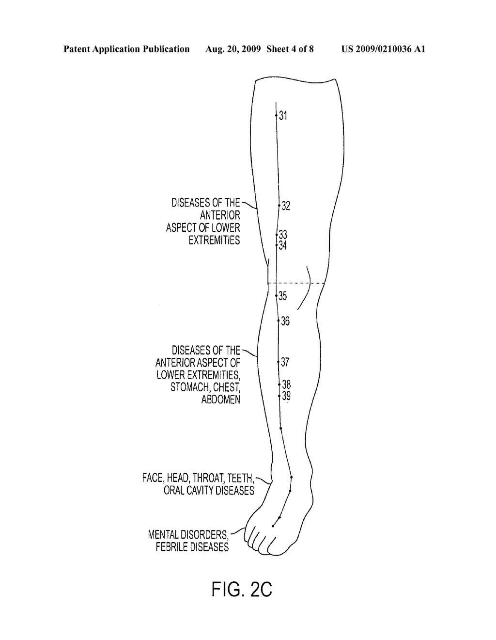 Laser ionization therapy system and method - diagram, schematic, and image 05