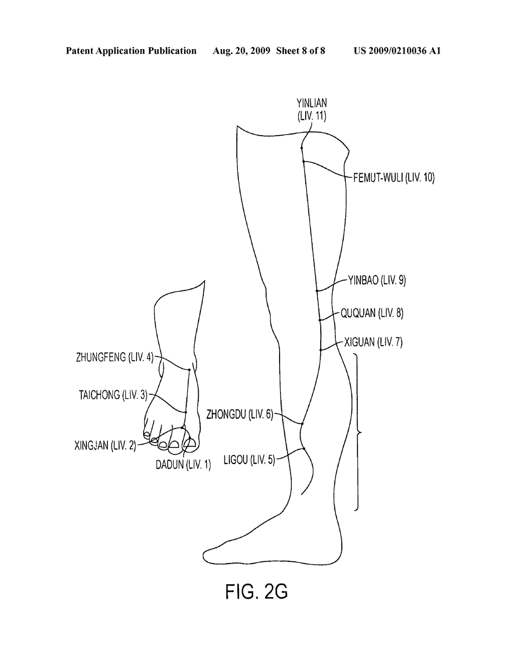 Laser ionization therapy system and method - diagram, schematic, and image 09