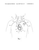 MEDICAL ELECTRICAL LEAD WITH PROXIMAL ARMORING diagram and image