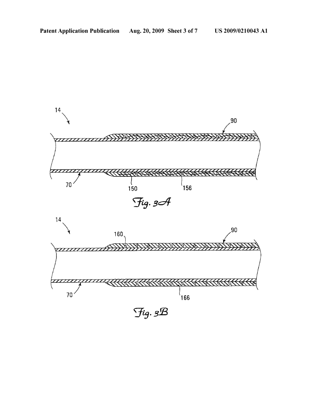 MEDICAL ELECTRICAL LEAD WITH PROXIMAL ARMORING - diagram, schematic, and image 04