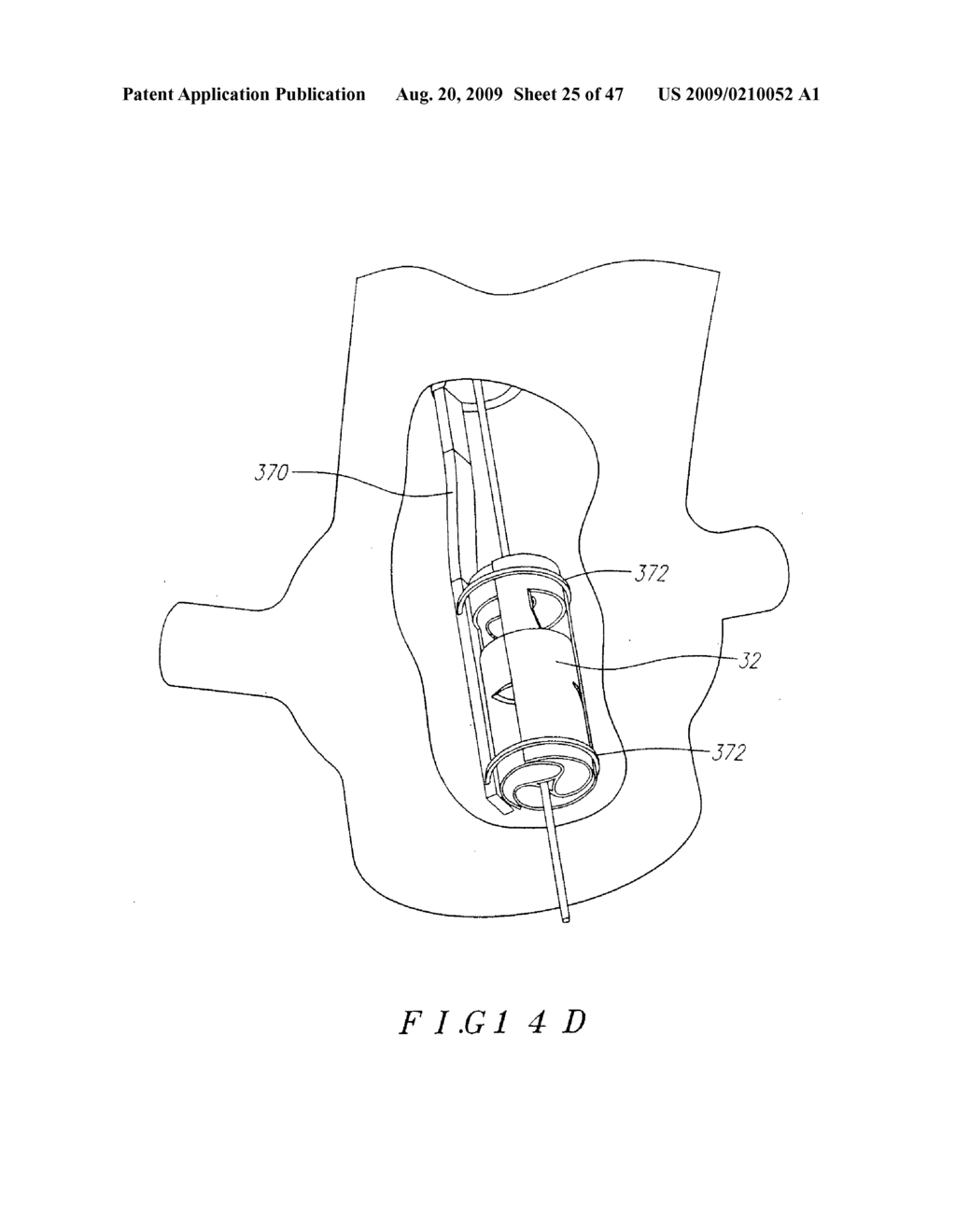 PROSTHETIC HEART VALVES, SUPPORT STRUCTURES AND SYSTEMS AND METHODS FOR IMPLANTING SAME - diagram, schematic, and image 26