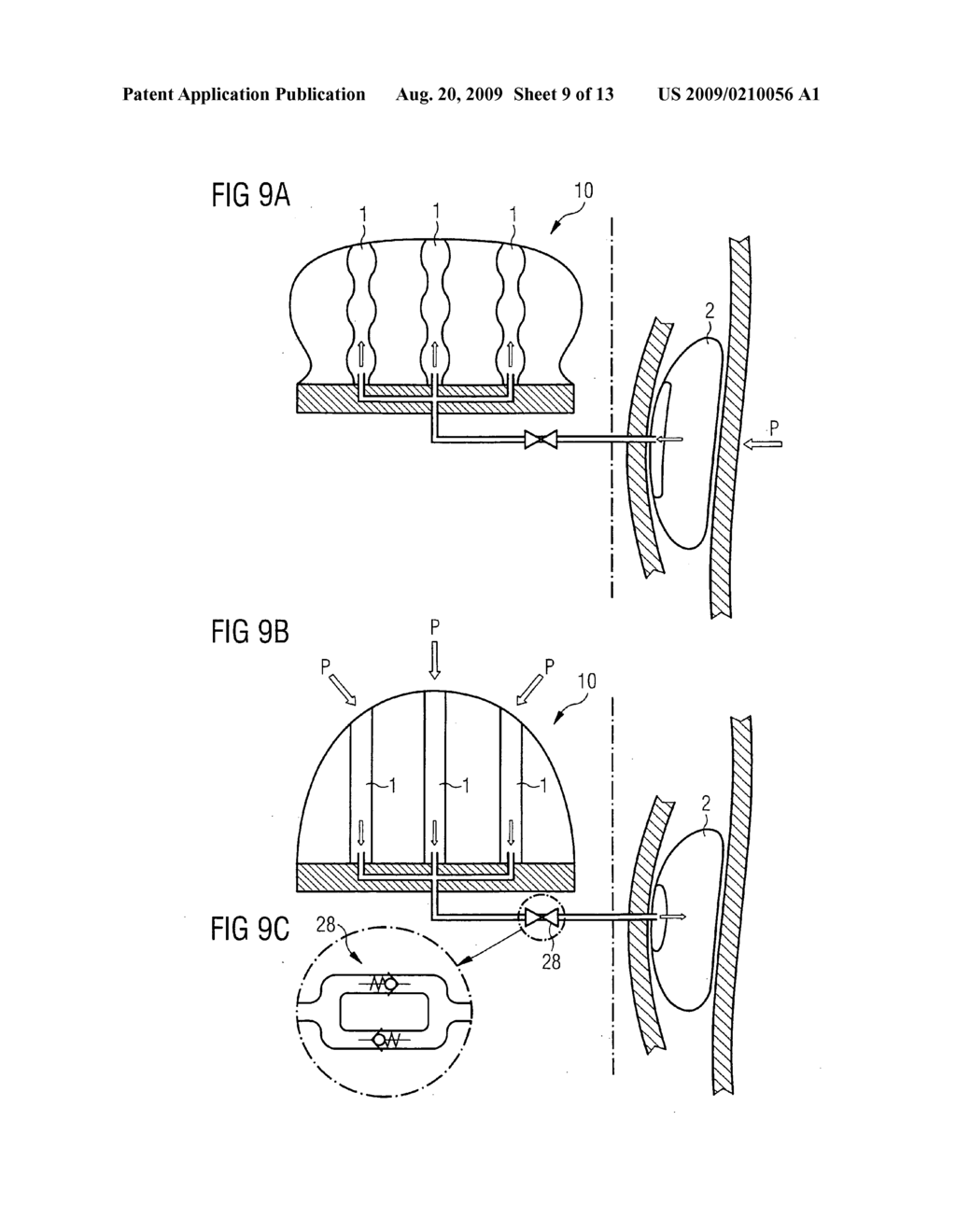 Breast implant system - diagram, schematic, and image 10