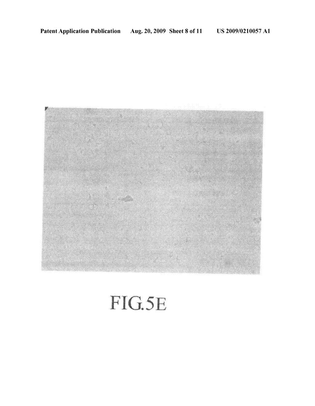 Multi-layered implant prepared by a method of tissue repair using a multi-layered matrix - diagram, schematic, and image 09