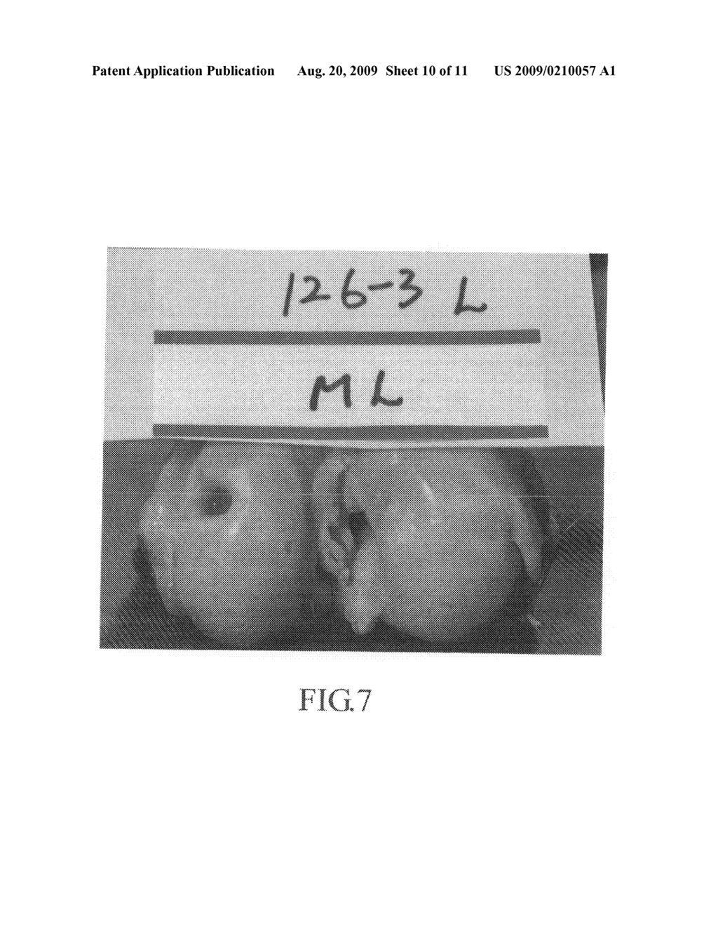 Multi-layered implant prepared by a method of tissue repair using a multi-layered matrix - diagram, schematic, and image 11