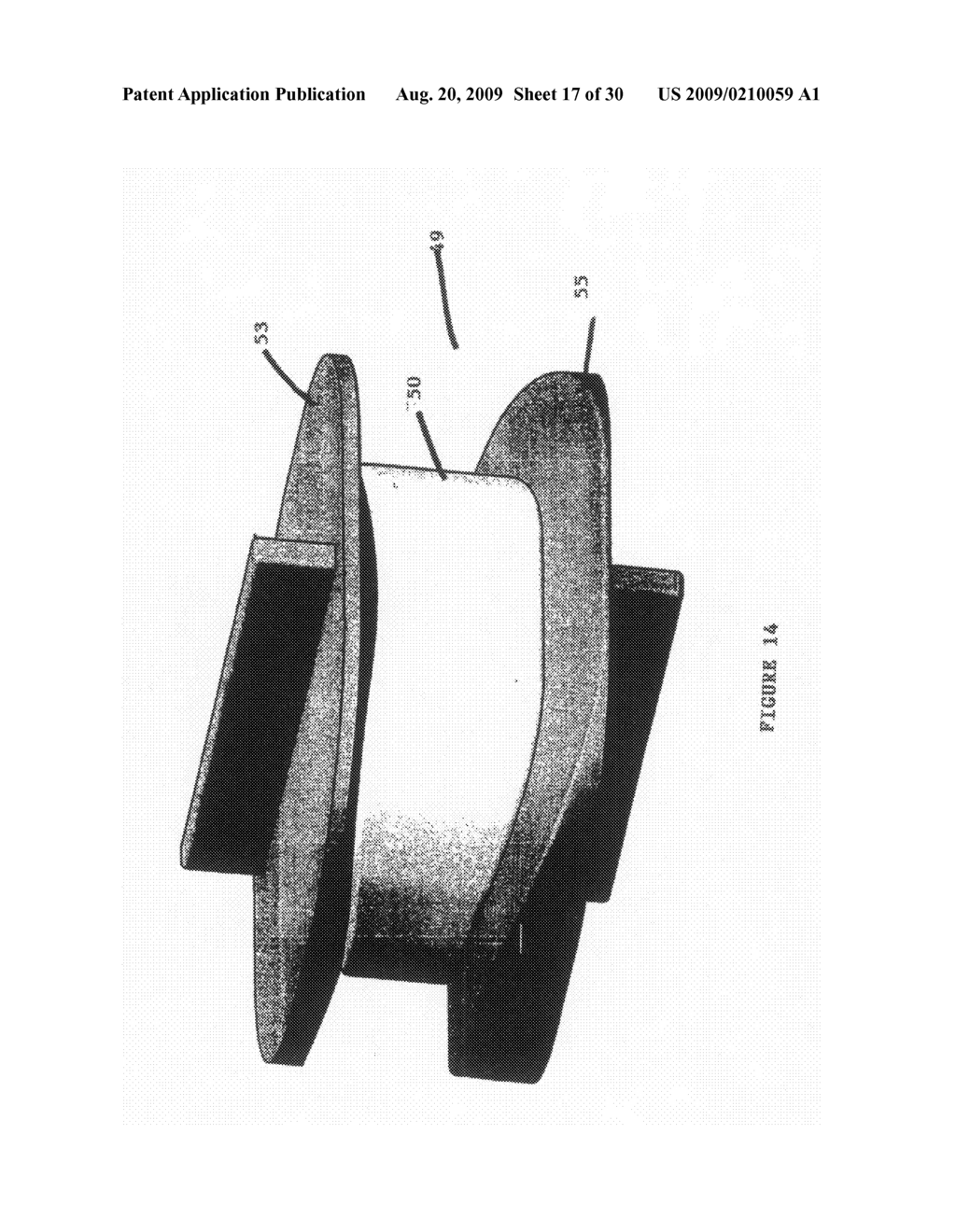 Vertebral Disc Prosthesis - diagram, schematic, and image 18