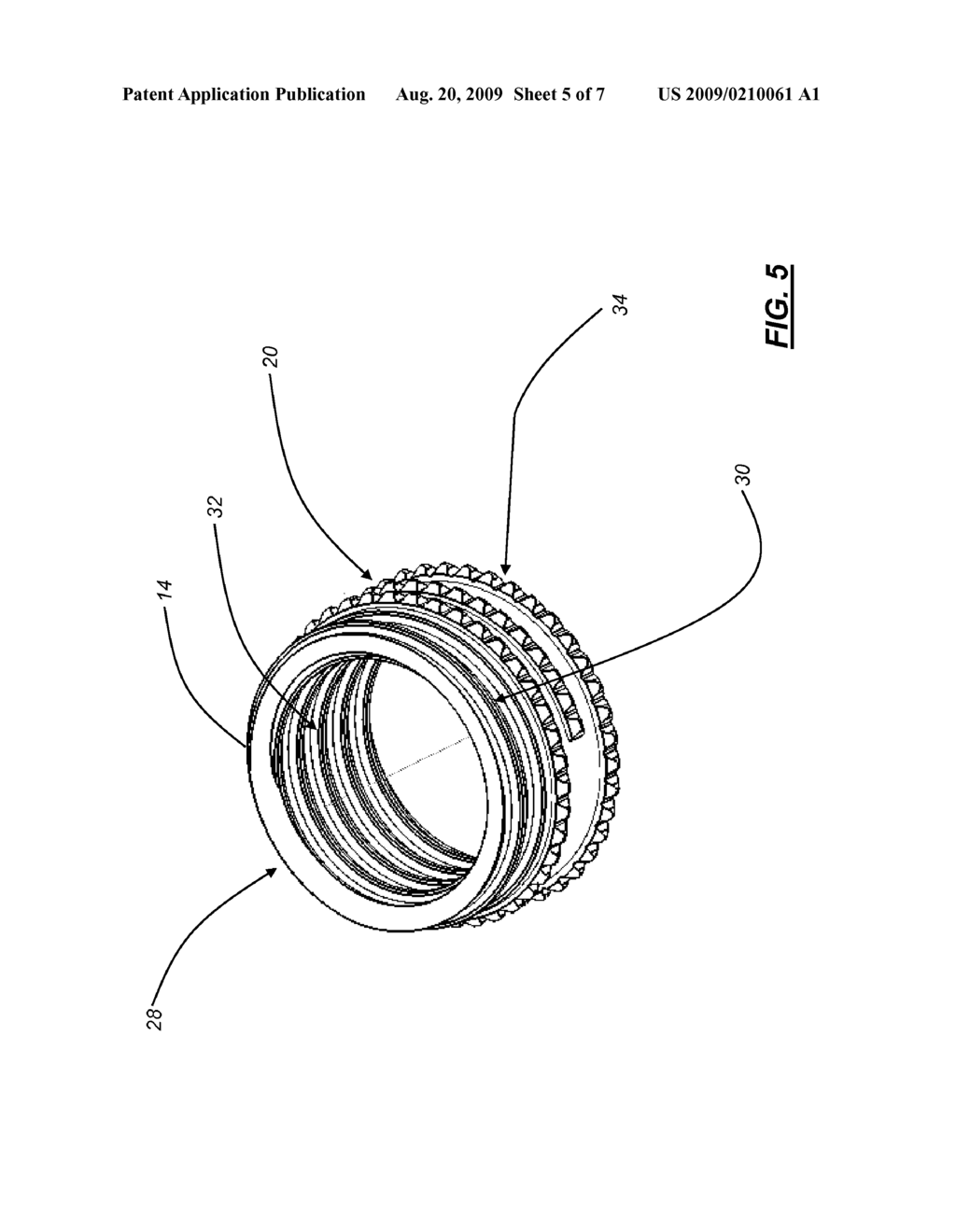 ANTERIOR LUMBAR INTERBODY FUSION CAGE DEVICE AND ASSOCIATED METHOD - diagram, schematic, and image 06