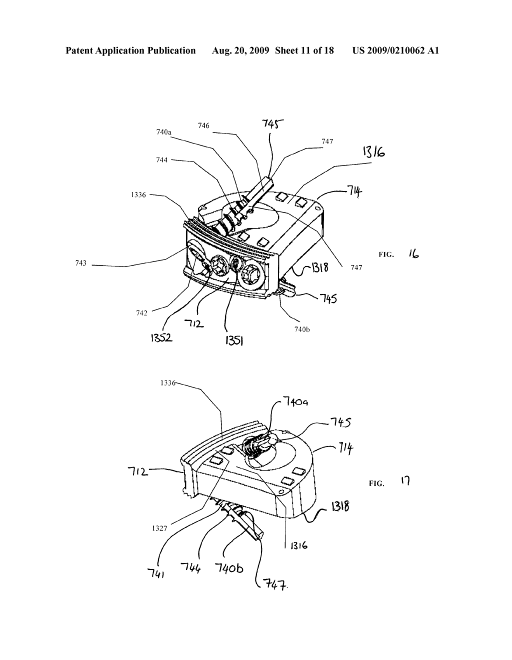 Orthopaedic Implants and Prostheses - diagram, schematic, and image 12