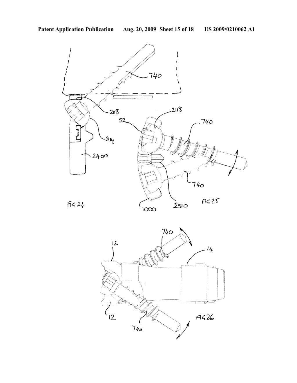 Orthopaedic Implants and Prostheses - diagram, schematic, and image 16