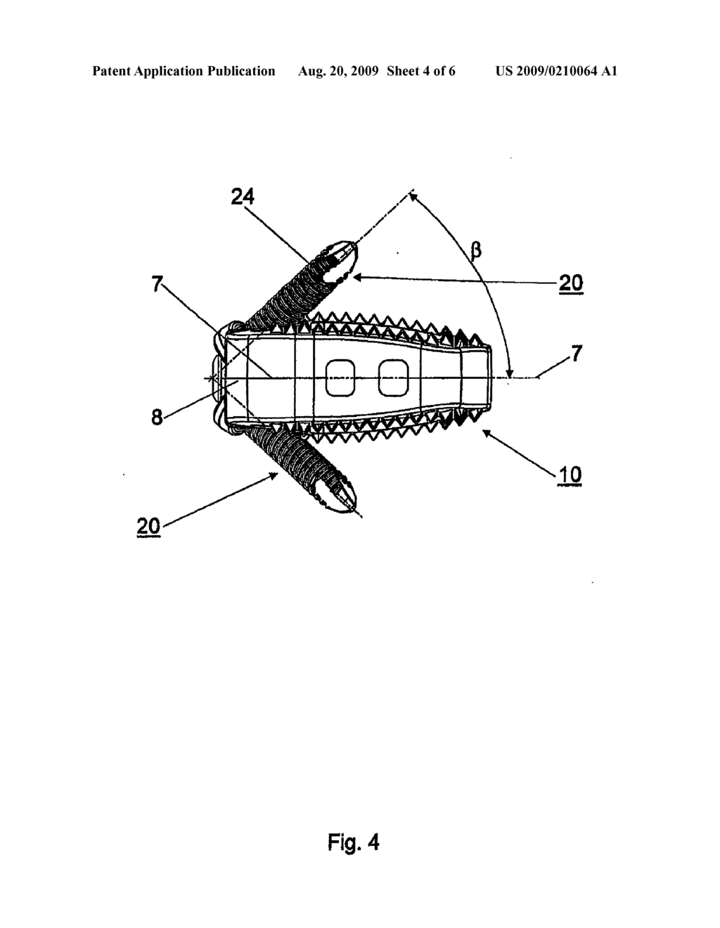 INTERVERTEBRAL IMPLANT - diagram, schematic, and image 05