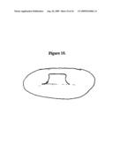 ANTERIOR CRUCIATE LIGAMENT SUBSTITUTING KNEE REPLACEMENT PROSTHESIS diagram and image