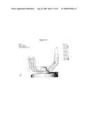 ANTERIOR CRUCIATE LIGAMENT SUBSTITUTING KNEE REPLACEMENT PROSTHESIS diagram and image