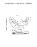 ANTERIOR CRUCIATE LIGAMENT SUBSTITUTING KNEE REPLACEMENT PROSTHESIS diagram and image