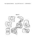 ANTERIOR CRUCIATE LIGAMENT SUBSTITUTING KNEE REPLACEMENT PROSTHESIS diagram and image