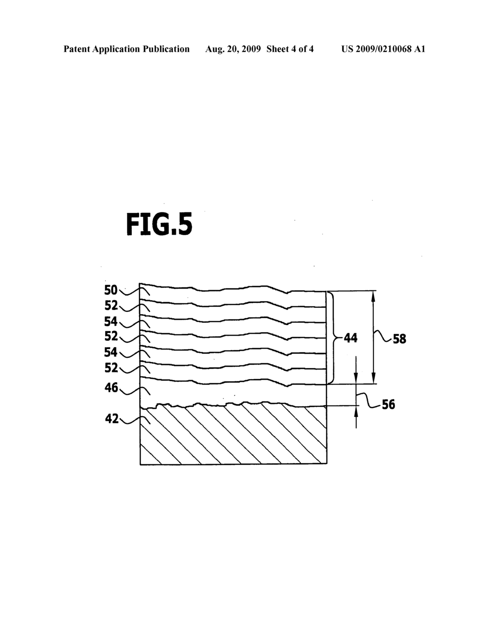 Implant and method for the production of an implant - diagram, schematic, and image 05