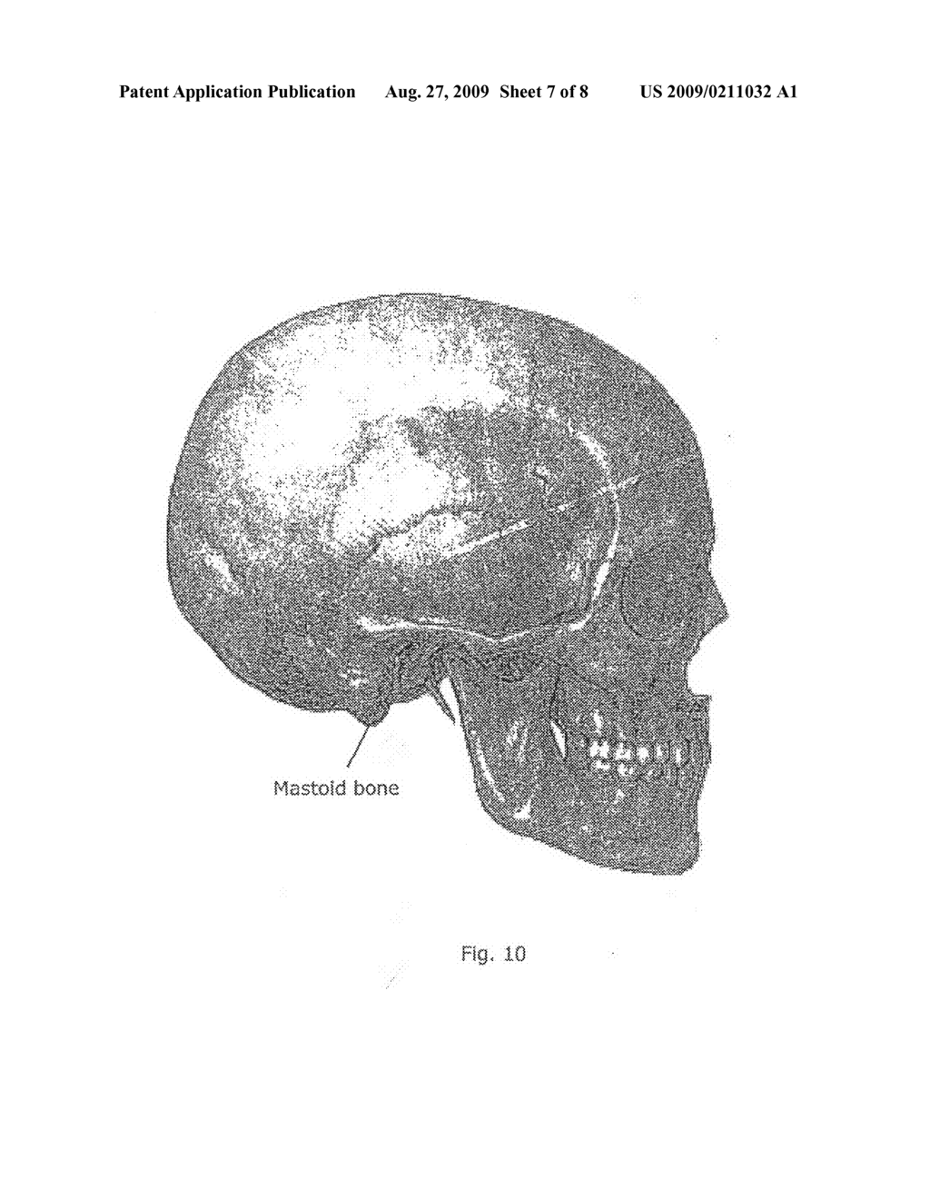 Support for supporting the neck and head of a human being - diagram, schematic, and image 08