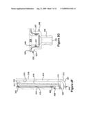 CRANKCASE VENTILATION SYSTEM diagram and image