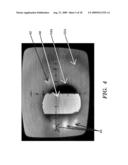 EVALUATING PUPILLARY RESPONSES TO LIGHT STIMULI diagram and image