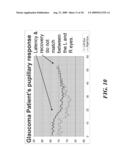 EVALUATING PUPILLARY RESPONSES TO LIGHT STIMULI diagram and image