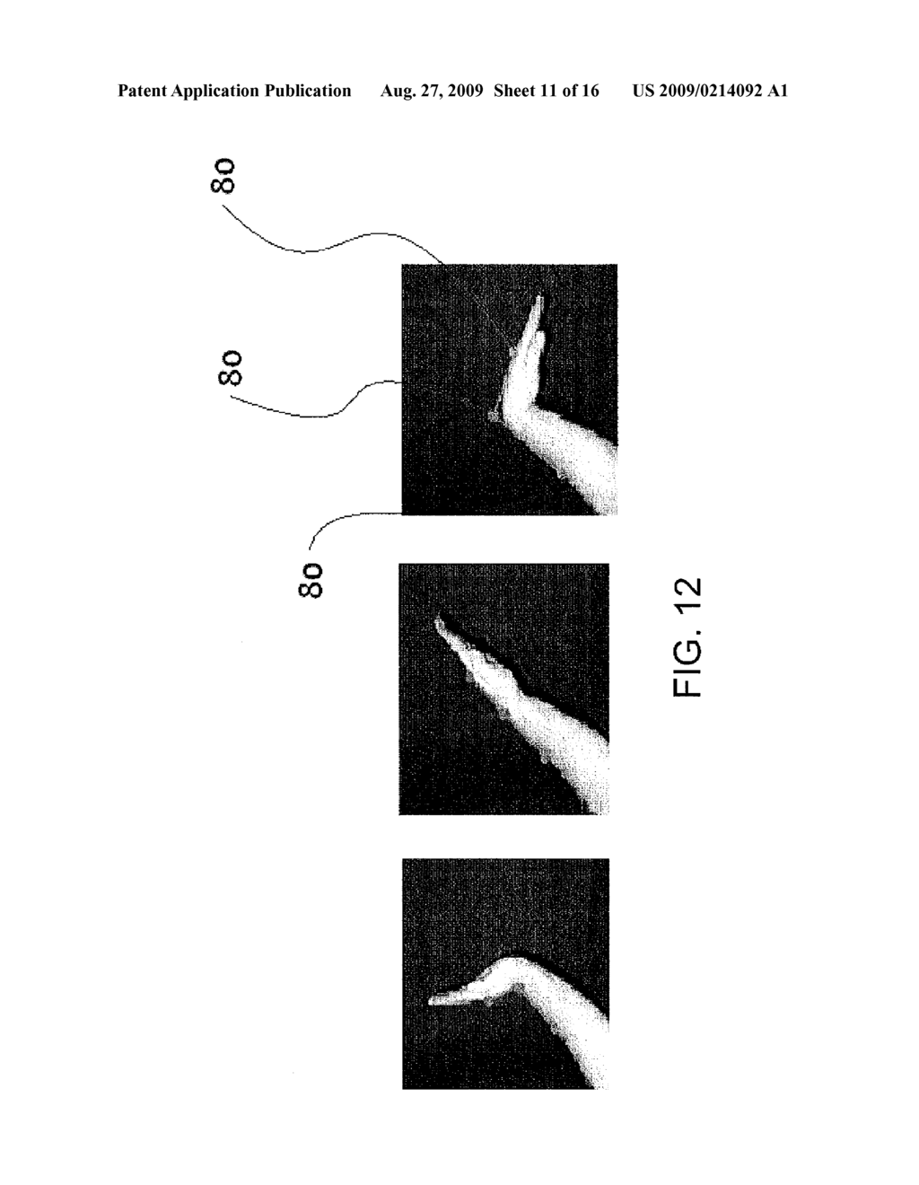 METHOD OF ASSESSING A BODY PART - diagram, schematic, and image 12