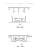 Closure Device Providing Visual Confirmation of Occlusion diagram and image