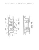 Closure Device Providing Visual Confirmation of Occlusion diagram and image