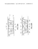 Closure Device Providing Visual Confirmation of Occlusion diagram and image