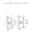 Closure Device Providing Visual Confirmation of Occlusion diagram and image